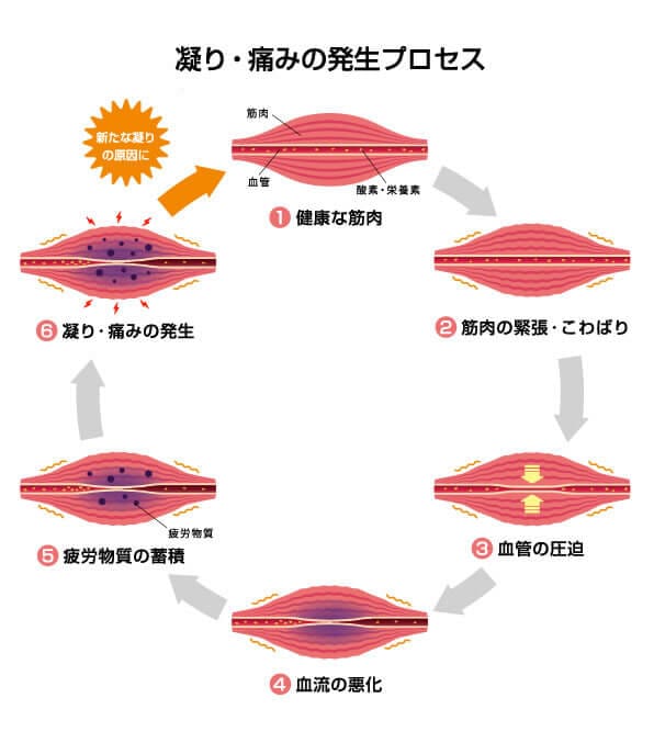 パソコン作業の肩こり予防に 今すぐ試せるストレッチと肩こり解消法 オフィスのギモン オフィスやオフィス家具の情報サイト